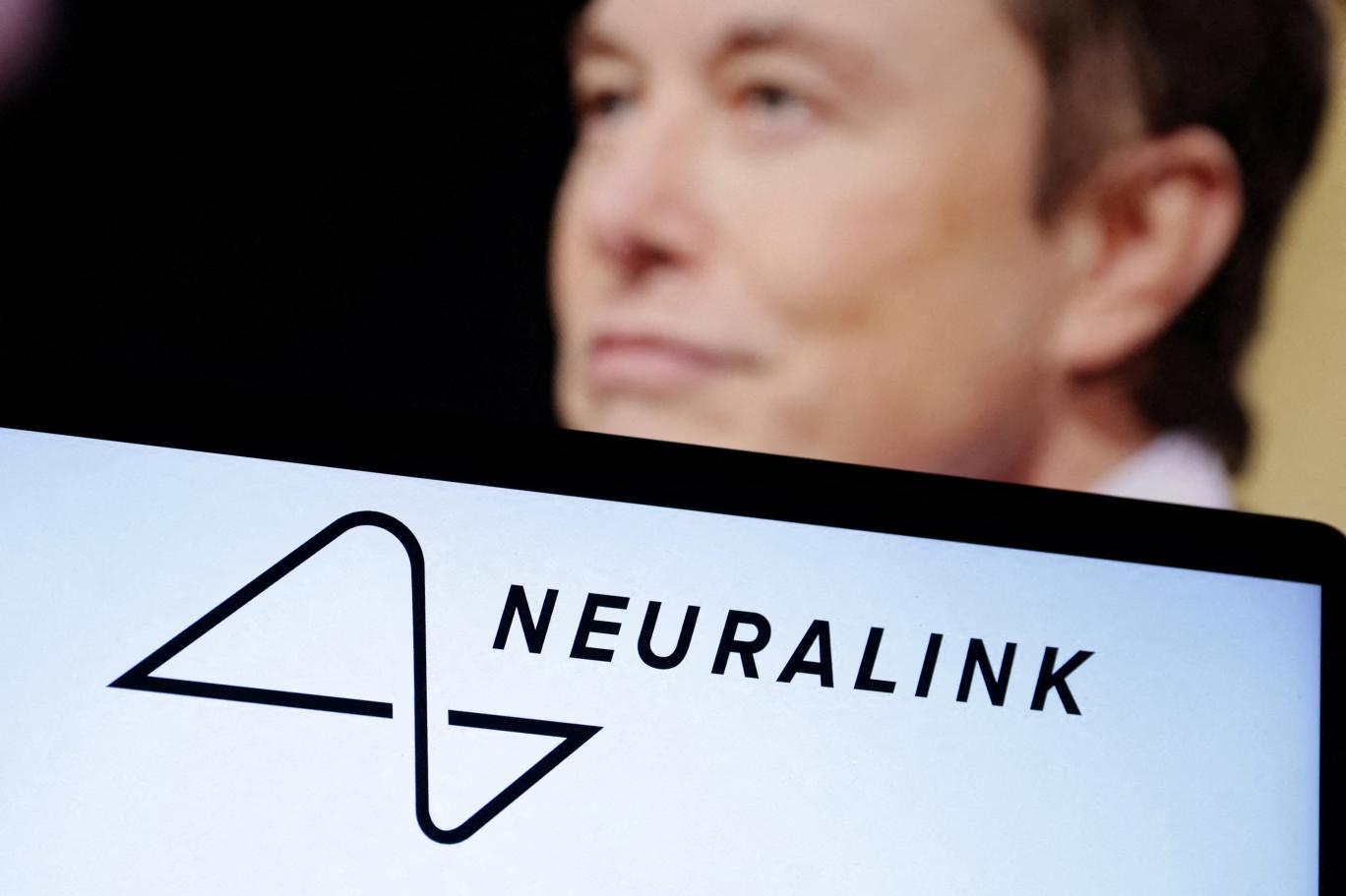 Neuralink, beyin implantı için FDA'dan "breakthrough device" (öncü cihaz) etiketi aldı